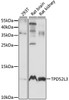 Western blot analysis of extracts of various cell lines, using TPD52L3 antibody (16-099) at 1:1000 dilution.<br/>Secondary antibody: HRP Goat Anti-Rabbit IgG (H+L) at 1:10000 dilution.<br/>Lysates/proteins: 25ug per lane.<br/>Blocking buffer: 3% nonfat dry milk in TBST.<br/>Detection: ECL Basic Kit.<br/>Exposure time: 10S.