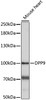 Western blot analysis of extracts of Mouse heart, using DPP9 antibody (16-101) at 1:1000 dilution.<br/>Secondary antibody: HRP Goat Anti-Rabbit IgG (H+L) at 1:10000 dilution.<br/>Lysates/proteins: 25ug per lane.<br/>Blocking buffer: 3% nonfat dry milk in TBST.<br/>Detection: ECL Basic Kit.<br/>Exposure time: 30S.