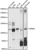 Western blot analysis of extracts of various cell lines, using GPRIN1 antibody (16-107) at 1:1000 dilution.<br/>Secondary antibody: HRP Goat Anti-Rabbit IgG (H+L) at 1:10000 dilution.<br/>Lysates/proteins: 25ug per lane.<br/>Blocking buffer: 3% nonfat dry milk in TBST.<br/>Detection: ECL Basic Kit.<br/>Exposure time: 5s.