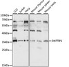 Western blot analysis of extracts of various cell lines, using DNTTIP1 antibody (16-109) at 1:1000 dilution.<br/>Secondary antibody: HRP Goat Anti-Rabbit IgG (H+L) at 1:10000 dilution.<br/>Lysates/proteins: 25ug per lane.<br/>Blocking buffer: 3% nonfat dry milk in TBST.<br/>Detection: ECL Basic Kit.<br/>Exposure time: 5S.