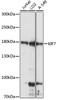 Western blot analysis of extracts of various cell lines, using KIF7 antibody (16-121) at 1:1000 dilution.<br/>Secondary antibody: HRP Goat Anti-Rabbit IgG (H+L) at 1:10000 dilution.<br/>Lysates/proteins: 25ug per lane.<br/>Blocking buffer: 3% nonfat dry milk in TBST.<br/>Detection: ECL Basic Kit.<br/>Exposure time: 5s.