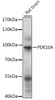 Western blot analysis of extracts of rat brain, using PDE10A antibody (16-127) at 1:1000 dilution.<br/>Secondary antibody: HRP Goat Anti-Rabbit IgG (H+L) at 1:10000 dilution.<br/>Lysates/proteins: 25ug per lane.<br/>Blocking buffer: 3% nonfat dry milk in TBST.<br/>Detection: ECL Basic Kit.<br/>Exposure time: 5s.