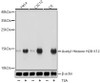 Western blot analysis of extracts of various cell lines, using Acetyl-Histone H2B-K12 antibody (16-140) at 1:1000 dilution.HeLa cells were treated by TSA (1 uM) at 37℃ for 18 hours.C2C12 cells were treated by TSA (1 uM) at 37℃ for 18 hours.C6 cells were treated by TSA (1 uM) at 37℃ for 18 hours.<br/>Secondary antibody: HRP Goat Anti-Rabbit IgG (H+L) at 1:10000 dilution.<br/>Lysates/proteins: 25ug per lane.<br/>Blocking buffer: 3% BSA.<br/>Detection: ECL Basic Kit.<br/>Exposure time: 1s.