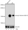 Western blot analysis of extracts of various cell lines, using Acetyl-Histone H2B-K5 antibody (16-142) at 1:1000 dilution.NIH/3T3 cells were treated by TSA (1 uM) at 37℃ for 18 hours.C6 cells were treated by TSA (1 uM) at 37℃ for 18 hours<br/>Secondary antibody: HRP Goat Anti-Rabbit IgG (H+L) at 1:10000 dilution.<br/>Lysates/proteins: 25ug per lane.<br/>Blocking buffer: 3% BSA.<br/>Detection: ECL Basic Kit.<br/>Exposure time: 60s.