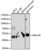 Western blot analysis of extracts of various cell lines, using RNF149 antibody (16-147) at 1:1000 dilution.<br/>Secondary antibody: HRP Goat Anti-Rabbit IgG (H+L) at 1:10000 dilution.<br/>Lysates/proteins: 25ug per lane.<br/>Blocking buffer: 3% nonfat dry milk in TBST.<br/>Detection: ECL Basic Kit.<br/>Exposure time: 30s.