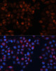 Immunofluorescence analysis of HeLa cells using CANX antibody (16-150) at dilution of 1:100. Blue: DAPI for nuclear staining.