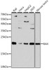 Western blot analysis of extracts of various cell lines, using BAX antibody (16-152) at 1:1000 dilution.<br/>Secondary antibody: HRP Goat Anti-Rabbit IgG (H+L) at 1:10000 dilution.<br/>Lysates/proteins: 25ug per lane.<br/>Blocking buffer: 3% nonfat dry milk in TBST.<br/>Detection: ECL Basic Kit.<br/>Exposure time: 30s.