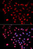 Immunofluorescence analysis of U2OS cells using CDK9 antibody (16-157) . Blue: DAPI for nuclear staining.