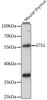 Western blot analysis of extracts of mouse thymus, using ETS1 antibody (16-168) at 1:1000 dilution.<br/>Secondary antibody: HRP Goat Anti-Rabbit IgG (H+L) at 1:10000 dilution.<br/>Lysates/proteins: 25ug per lane.<br/>Blocking buffer: 3% nonfat dry milk in TBST.<br/>Detection: ECL Basic Kit.<br/>Exposure time: 60s.