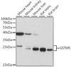 Western blot analysis of extracts of various cell lines, using GSTM5 antibody (16-175) at 1:1000 dilution.<br/>Secondary antibody: HRP Goat Anti-Rabbit IgG (H+L) at 1:10000 dilution.<br/>Lysates/proteins: 25ug per lane.<br/>Blocking buffer: 3% nonfat dry milk in TBST.<br/>Detection: ECL Basic Kit.<br/>Exposure time: 3s.