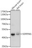 Western blot analysis of extracts of various cell lines, using SERPINI1 antibody (16-189) at 1:1000 dilution.<br/>Secondary antibody: HRP Goat Anti-Rabbit IgG (H+L) at 1:10000 dilution.<br/>Lysates/proteins: 25ug per lane.<br/>Blocking buffer: 3% nonfat dry milk in TBST.<br/>Detection: ECL Enhanced Kit.<br/>Exposure time: 90s.