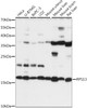 Western blot analysis of extracts of various cell lines, using RPS13 antibody (16-197) at 1:1000 dilution.<br/>Secondary antibody: HRP Goat Anti-Rabbit IgG (H+L) at 1:10000 dilution.<br/>Lysates/proteins: 25ug per lane.<br/>Blocking buffer: 3% nonfat dry milk in TBST.<br/>Detection: ECL Basic Kit.<br/>Exposure time: 20s.