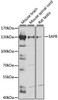 Western blot analysis of extracts of various cell lines, using SAFB antibody (16-198) at 1:1000 dilution.<br/>Secondary antibody: HRP Goat Anti-Rabbit IgG (H+L) at 1:10000 dilution.<br/>Lysates/proteins: 25ug per lane.<br/>Blocking buffer: 3% nonfat dry milk in TBST.<br/>Detection: ECL Enhanced Kit.<br/>Exposure time: 20s.