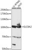Western blot analysis of extracts of various cell lines, using SLC8A2 antibody (16-200) at 1:1000 dilution.<br/>Secondary antibody: HRP Goat Anti-Rabbit IgG (H+L) at 1:10000 dilution.<br/>Lysates/proteins: 25ug per lane.<br/>Blocking buffer: 3% nonfat dry milk in TBST.<br/>Detection: ECL Basic Kit.<br/>Exposure time: 10s.