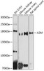 Western blot analysis of extracts of various cell lines, using A2M antibody (16-203) at 1:500 dilution.<br/>Secondary antibody: HRP Goat Anti-Rabbit IgG (H+L) at 1:10000 dilution.<br/>Lysates/proteins: 25ug per lane.<br/>Blocking buffer: 3% nonfat dry milk in TBST.<br/>Detection: ECL Basic Kit.<br/>Exposure time: 60s.