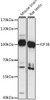 Western blot analysis of extracts of various cell lines, using KIF3B antibody (16-215) at 1:1000 dilution.<br/>Secondary antibody: HRP Goat Anti-Rabbit IgG (H+L) at 1:10000 dilution.<br/>Lysates/proteins: 25ug per lane.<br/>Blocking buffer: 3% nonfat dry milk in TBST.<br/>Detection: ECL Basic Kit.<br/>Exposure time: 30s.