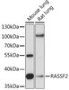 Western blot analysis of extracts of various cell lines, using RASSF2 antibody (16-223) at 1:1000 dilution.<br/>Secondary antibody: HRP Goat Anti-Rabbit IgG (H+L) at 1:10000 dilution.<br/>Lysates/proteins: 25ug per lane.<br/>Blocking buffer: 3% nonfat dry milk in TBST.<br/>Detection: ECL Enhanced Kit.<br/>Exposure time: 1s.