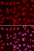 Immunofluorescence analysis of U2OS cells using SIN3A antibody (16-224) . Blue: DAPI for nuclear staining.