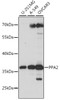 Western blot analysis of extracts of various cell lines, using PPA2 antibody (16-253) at 1:1000 dilution.<br/>Secondary antibody: HRP Goat Anti-Rabbit IgG (H+L) at 1:10000 dilution.<br/>Lysates/proteins: 25ug per lane.<br/>Blocking buffer: 3% nonfat dry milk in TBST.<br/>Detection: ECL Basic Kit.<br/>Exposure time: 10s.