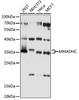 Western blot analysis of extracts of various cell lines, using MMADHC antibody (16-255) at 1:1000 dilution.<br/>Secondary antibody: HRP Goat Anti-Rabbit IgG (H+L) at 1:10000 dilution.<br/>Lysates/proteins: 25ug per lane.<br/>Blocking buffer: 3% nonfat dry milk in TBST.<br/>Detection: ECL Basic Kit.<br/>Exposure time: 10s.
