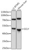 Western blot analysis of extracts of various cell lines, using SCLY antibody (16-270) at 1:1000 dilution.<br/>Secondary antibody: HRP Goat Anti-Rabbit IgG (H+L) at 1:10000 dilution.<br/>Lysates/proteins: 25ug per lane.<br/>Blocking buffer: 3% nonfat dry milk in TBST.<br/>Detection: ECL Basic Kit.<br/>Exposure time: 30s.