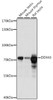 Western blot analysis of extracts of various cell lines, using DDX43 antibody (16-281) at 1:1000 dilution.<br/>Secondary antibody: HRP Goat Anti-Rabbit IgG (H+L) at 1:10000 dilution.<br/>Lysates/proteins: 25ug per lane.<br/>Blocking buffer: 3% nonfat dry milk in TBST.<br/>Detection: ECL Basic Kit.<br/>Exposure time: 10s.