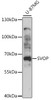 Western blot analysis of extracts of U-87MG cells, using SVOP antibody (16-282) at 1:1000 dilution.<br/>Secondary antibody: HRP Goat Anti-Rabbit IgG (H+L) at 1:10000 dilution.<br/>Lysates/proteins: 25ug per lane.<br/>Blocking buffer: 3% nonfat dry milk in TBST.<br/>Detection: ECL Basic Kit.<br/>Exposure time: 5s.