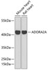 Western blot analysis of extracts of various cell lines, using ADORA2A antibody (16-289) at 1:1000 dilution.<br/>Secondary antibody: HRP Goat Anti-Rabbit IgG (H+L) at 1:10000 dilution.<br/>Lysates/proteins: 25ug per lane.<br/>Blocking buffer: 3% nonfat dry milk in TBST.<br/>Detection: ECL Enhanced Kit.<br/>Exposure time: 90s.