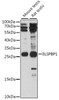 Western blot analysis of extracts of various cell lines, using ELSPBP1 antibody (16-296) at 1:1000 dilution.<br/>Secondary antibody: HRP Goat Anti-Rabbit IgG (H+L) at 1:10000 dilution.<br/>Lysates/proteins: 25ug per lane.<br/>Blocking buffer: 3% nonfat dry milk in TBST.<br/>Detection: ECL Basic Kit.<br/>Exposure time: 90s.