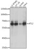 Western blot analysis of extracts of various cell lines, using ATL2 antibody (16-298) at 1:1000 dilution.<br/>Secondary antibody: HRP Goat Anti-Rabbit IgG (H+L) at 1:10000 dilution.<br/>Lysates/proteins: 25ug per lane.<br/>Blocking buffer: 3% nonfat dry milk in TBST.<br/>Detection: ECL Basic Kit.<br/>Exposure time: 10s.