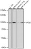 Western blot analysis of extracts of various cell lines, using VPS16 antibody (16-302) at 1:1000 dilution.<br/>Secondary antibody: HRP Goat Anti-Rabbit IgG (H+L) at 1:10000 dilution.<br/>Lysates/proteins: 25ug per lane.<br/>Blocking buffer: 3% nonfat dry milk in TBST.<br/>Detection: ECL Basic Kit.<br/>Exposure time: 1s.