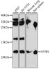 Western blot analysis of extracts of various cell lines, using SF3B5 antibody (16-315) at 1:1000 dilution.<br/>Secondary antibody: HRP Goat Anti-Rabbit IgG (H+L) at 1:10000 dilution.<br/>Lysates/proteins: 25ug per lane.<br/>Blocking buffer: 3% nonfat dry milk in TBST.<br/>Detection: ECL Enhanced Kit.<br/>Exposure time: 90s.