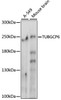 Western blot analysis of extracts of various cell lines, using TUBGCP6 antibody (16-323) at 1000 dilution.<br/>Secondary antibody: HRP Goat Anti-Rabbit IgG (H+L) at 1:10000 dilution.<br/>Lysates/proteins: 25ug per lane.<br/>Blocking buffer: 3% nonfat dry milk in TBST.<br/>Detection: ECL Basic Kit.<br/>Exposure time: 10s.