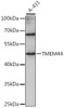 Western blot analysis of extracts of A-431 cells, using TMEM44 antibody (16-329) at 1:1000 dilution.<br/>Secondary antibody: HRP Goat Anti-Rabbit IgG (H+L) at 1:10000 dilution.<br/>Lysates/proteins: 25ug per lane.<br/>Blocking buffer: 3% nonfat dry milk in TBST.<br/>Detection: ECL Basic Kit.<br/>Exposure time: 30s.