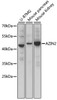 Western blot analysis of extracts of various cell lines, using AZIN2 antibody (16-332) at 1000 dilution.<br/>Secondary antibody: HRP Goat Anti-Rabbit IgG (H+L) at 1:10000 dilution.<br/>Lysates/proteins: 25ug per lane.<br/>Blocking buffer: 3% nonfat dry milk in TBST.<br/>Detection: ECL Basic Kit.<br/>Exposure time: 30s.