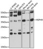 Western blot analysis of extracts of various cell lines, using RSPH9 antibody (16-356) at 1000 dilution.<br/>Secondary antibody: HRP Goat Anti-Rabbit IgG (H+L) at 1:10000 dilution.<br/>Lysates/proteins: 25ug per lane.<br/>Blocking buffer: 3% nonfat dry milk in TBST.<br/>Detection: ECL Basic Kit.<br/>Exposure time: 10s.