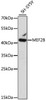 Western blot analysis of extracts of SH-SY5Y cells, using MEF2B antibody (16-364) at 1:1000 dilution.<br/>Secondary antibody: HRP Goat Anti-Rabbit IgG (H+L) at 1:10000 dilution.<br/>Lysates/proteins: 25ug per lane.<br/>Blocking buffer: 3% nonfat dry milk in TBST.<br/>Detection: ECL Basic Kit.<br/>Exposure time: 3min.