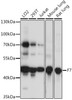 Western blot analysis of extracts of various cell lines, using F7 antibody (16-394) at 1:1000 dilution.<br/>Secondary antibody: HRP Goat Anti-Rabbit IgG (H+L) at 1:10000 dilution.<br/>Lysates/proteins: 25ug per lane.<br/>Blocking buffer: 3% nonfat dry milk in TBST.<br/>Detection: ECL Basic Kit.<br/>Exposure time: 30s.