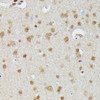 Immunohistochemistry of paraffin-embedded rat brain using IGHMBP2 antibody (16-402) at dilution of 1:100 (40x lens) .