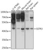 Western blot analysis of extracts of various cell lines, using SSTR3 antibody (16-412) at 1:1000 dilution.<br/>Secondary antibody: HRP Goat Anti-Rabbit IgG (H+L) at 1:10000 dilution.<br/>Lysates/proteins: 25ug per lane.<br/>Blocking buffer: 3% nonfat dry milk in TBST.<br/>Detection: ECL Basic Kit.<br/>Exposure time: 1s.