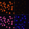 Immunofluorescence analysis of HeLa cells using Acetyl-Histone H3-K4 antibody (16-416) at dilution of 1:100.HeLa cells were treated by TSA (1 uM) at 37℃ for 18 hours. Blue: DAPI for nuclear staining.