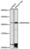 Western blot analysis of extracts of various cell lines, using DENND4A antibody (16-426) at 1:1000 dilution.<br/>Secondary antibody: HRP Goat Anti-Rabbit IgG (H+L) at 1:10000 dilution.<br/>Lysates/proteins: 25ug per lane.<br/>Blocking buffer: 3% nonfat dry milk in TBST.<br/>Detection: ECL Basic Kit.<br/>Exposure time: 30s.