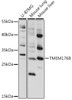 Western blot analysis of extracts of various cell lines, using TMEM176B antibody (16-441) at 1:1000 dilution.<br/>Secondary antibody: HRP Goat Anti-Rabbit IgG (H+L) at 1:10000 dilution.<br/>Lysates/proteins: 25ug per lane.<br/>Blocking buffer: 3% nonfat dry milk in TBST.<br/>Detection: ECL Basic Kit.<br/>Exposure time: 5s.