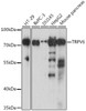 Western blot analysis of extracts of various cell lines, using TRPV6 antibody (16-447) at 1:1000 dilution.<br/>Secondary antibody: HRP Goat Anti-Rabbit IgG (H+L) at 1:10000 dilution.<br/>Lysates/proteins: 25ug per lane.<br/>Blocking buffer: 3% nonfat dry milk in TBST.<br/>Detection: ECL Basic Kit.<br/>Exposure time: 30s.