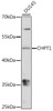 Western blot analysis of extracts of DU145 cells, using CHPT1 antibody (16-451) at 1:1000 dilution.<br/>Secondary antibody: HRP Goat Anti-Rabbit IgG (H+L) at 1:10000 dilution.<br/>Lysates/proteins: 25ug per lane.<br/>Blocking buffer: 3% nonfat dry milk in TBST.<br/>Detection: ECL Basic Kit.<br/>Exposure time: 30s.