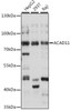 Western blot analysis of extracts of various cell lines, using ACAD11 antibody (16-458) at 1:1000 dilution.<br/>Secondary antibody: HRP Goat Anti-Rabbit IgG (H+L) at 1:10000 dilution.<br/>Lysates/proteins: 25ug per lane.<br/>Blocking buffer: 3% nonfat dry milk in TBST.<br/>Detection: ECL Basic Kit.<br/>Exposure time: 30s.