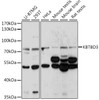 Western blot analysis of extracts of various cell lines, using KBTBD3 antibody (16-472) at 1:1000 dilution.<br/>Secondary antibody: HRP Goat Anti-Rabbit IgG (H+L) at 1:10000 dilution.<br/>Lysates/proteins: 25ug per lane.<br/>Blocking buffer: 3% nonfat dry milk in TBST.<br/>Detection: ECL Basic Kit.<br/>Exposure time: 30s.