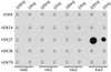 Dot-blot analysis of all sorts of methylation peptides using TriMethyl-Histone H3-K27 antibody (16-486) at 1:1000 dilution.