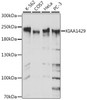 Western blot analysis of extracts of various cell lines, using KIAA1429 antibody (16-489) at 1:1000 dilution.<br/>Secondary antibody: HRP Goat Anti-Rabbit IgG (H+L) at 1:10000 dilution.<br/>Lysates/proteins: 25ug per lane.<br/>Blocking buffer: 3% nonfat dry milk in TBST.<br/>Detection: ECL Basic Kit.<br/>Exposure time: 1s.