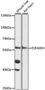 Western blot analysis of extracts of various cell lines, using D2HGDH antibody (16-493) at 1:1000 dilution.<br/>Secondary antibody: HRP Goat Anti-Rabbit IgG (H+L) at 1:10000 dilution.<br/>Lysates/proteins: 25ug per lane.<br/>Blocking buffer: 3% nonfat dry milk in TBST.<br/>Detection: ECL Basic Kit.<br/>Exposure time: 90s.